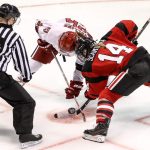 Hockey player looses teeths
